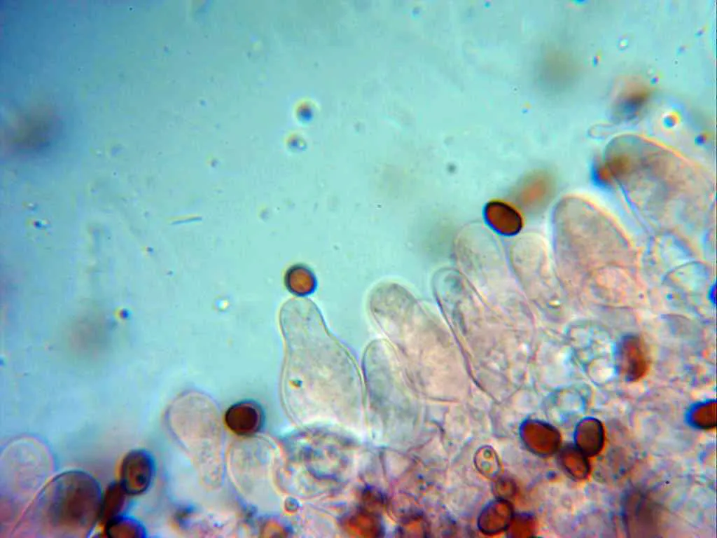 Microscopía de Psathyrella murrillii - 10 - Queilocistidios 2